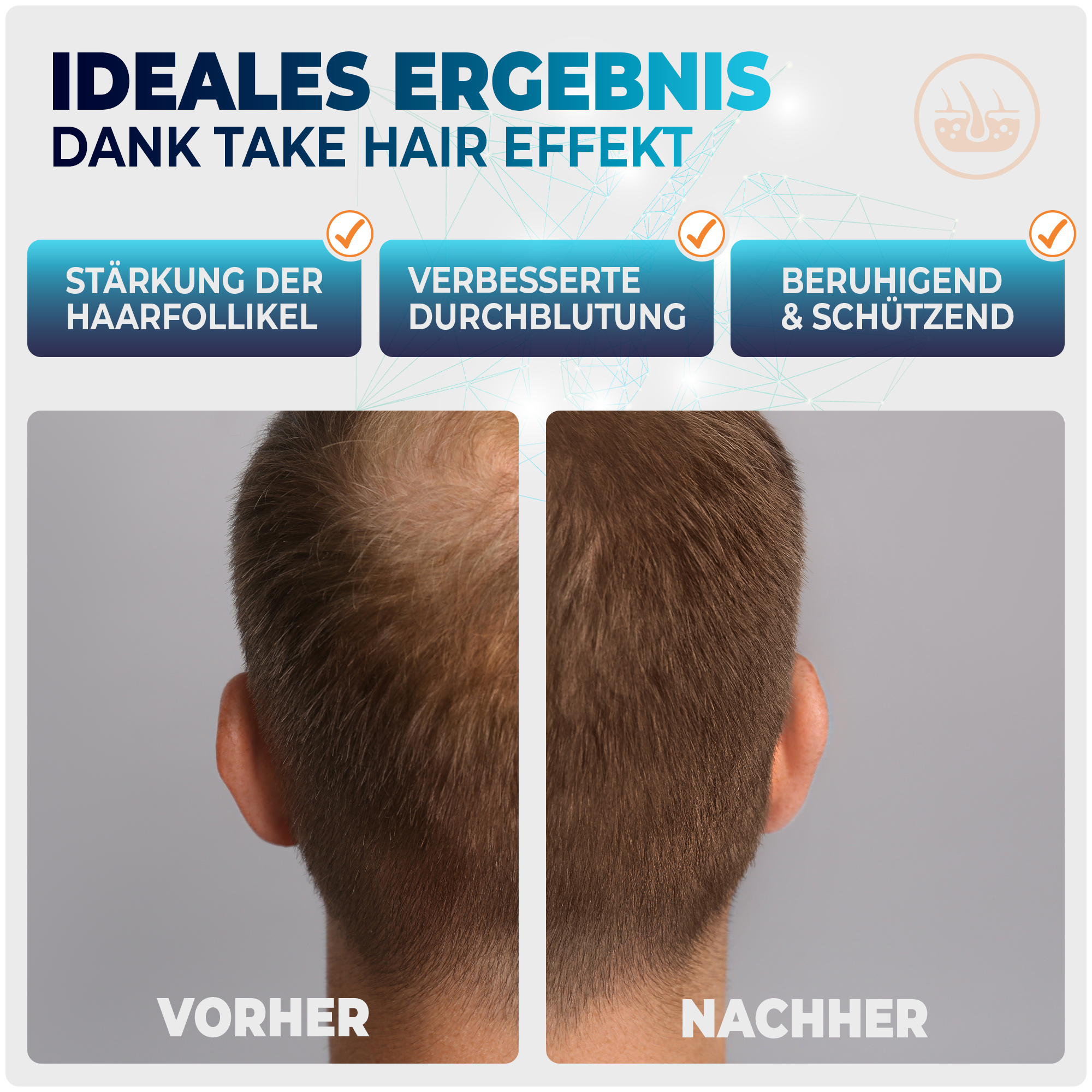 Anti-Haarausfall Schaum für Männer mit Redensyl® & Procapil® – 2 Monate Vorrat (100 ml) – für volleres, kräftigeres Haar – Panthenol, Ciatonic® HA – inkl. Masterclass
