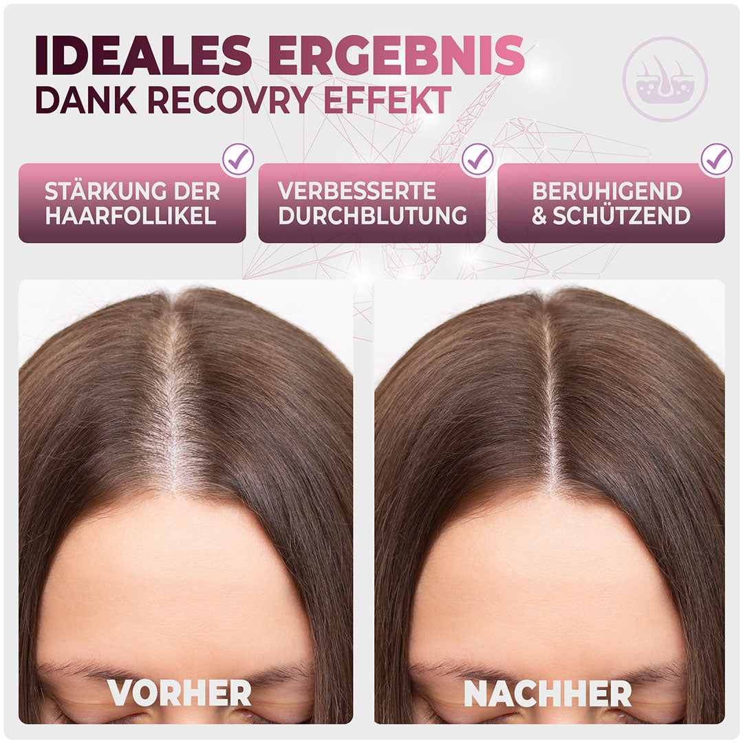 RECOVRY Anti Haarausfall Schaum für Frauen Ergebnis im Vorher Nachher Vergleich