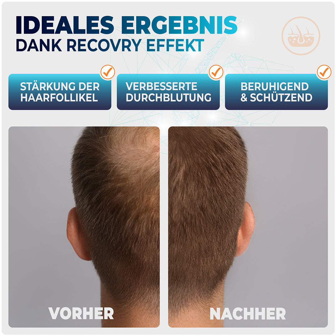 RECOVRY Premium Haarschaum für Männer Ergebnis im Vorher Nachher Vergleich