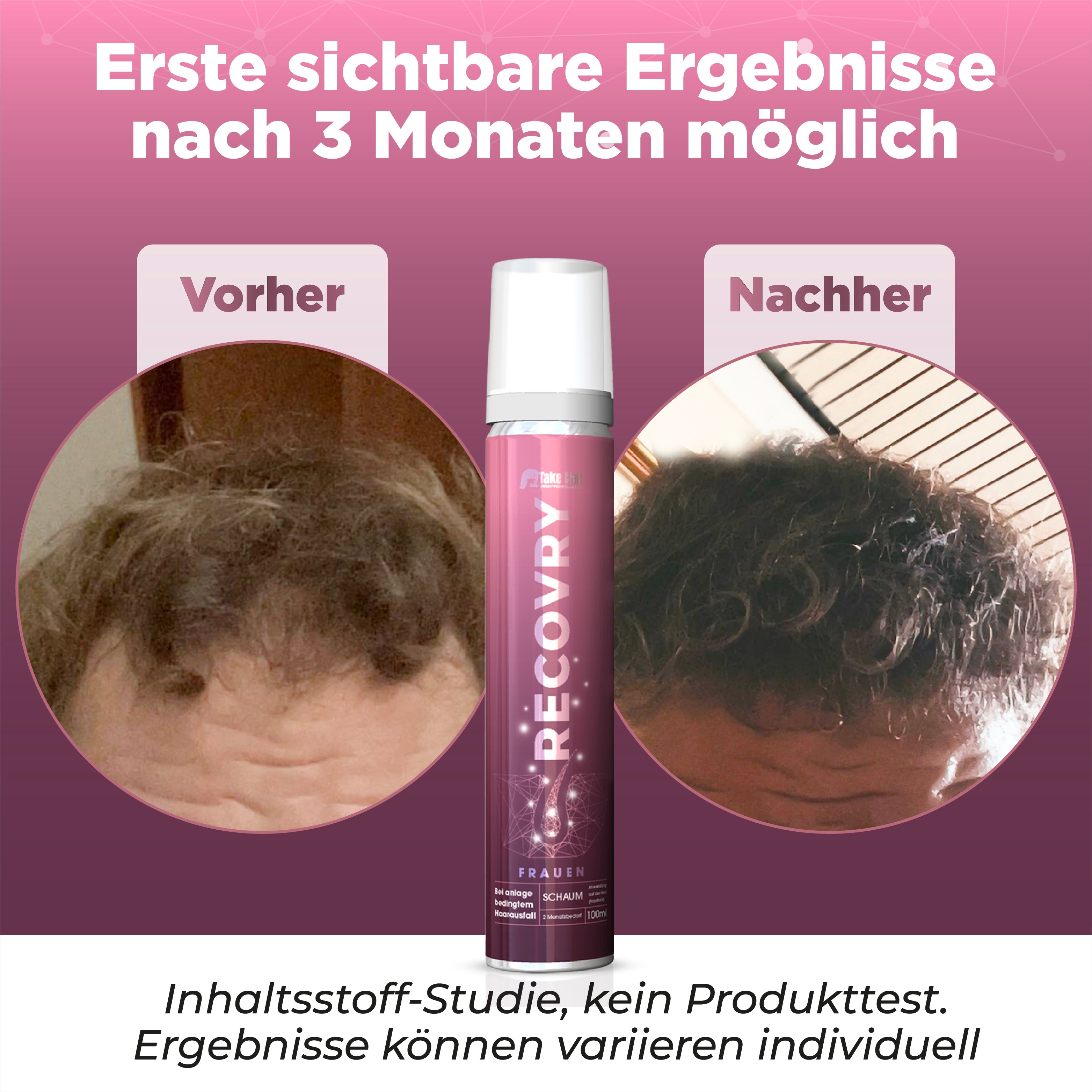 Anti-Haarausfall Schaum für Frauen mit Redensyl® & Procapil® – 2 Monate Vorrat (100 ml) – für volleres, kräftigeres Haar – Panthenol, Ciatonic® HA – inkl. Masterclass
